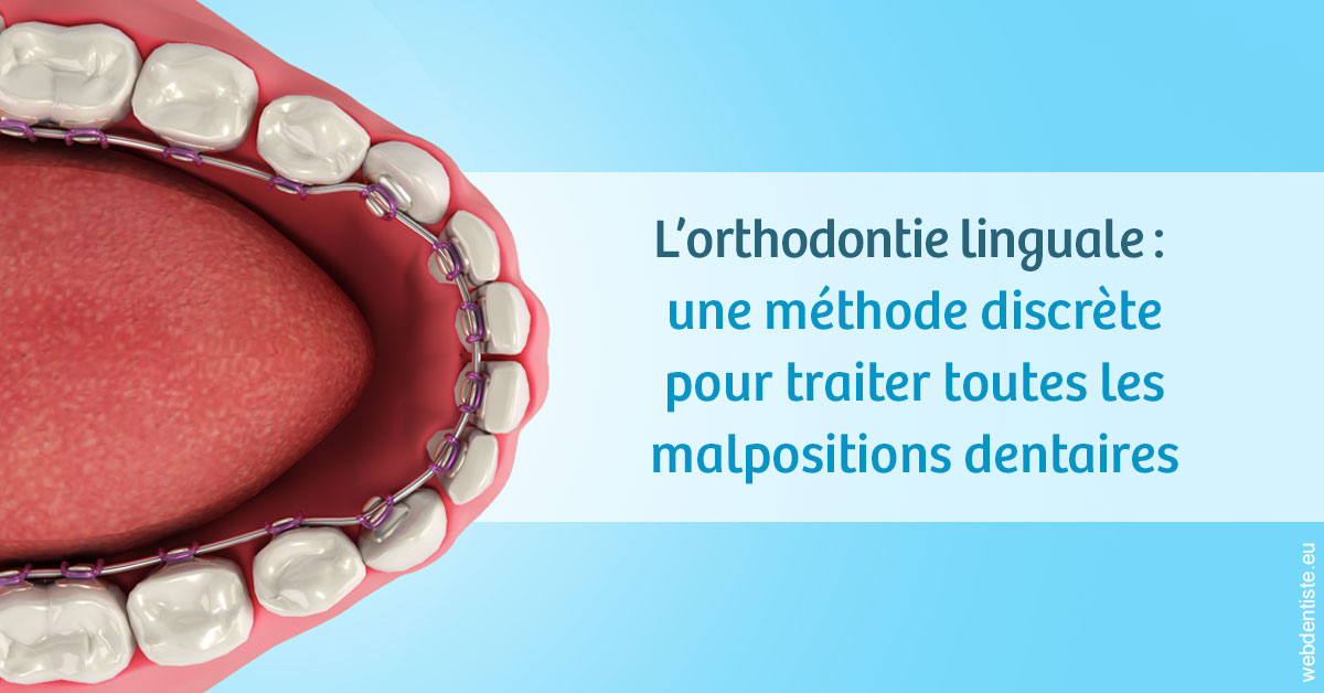 https://www.dr-feraud-pedodontiste.fr/L'orthodontie linguale 1