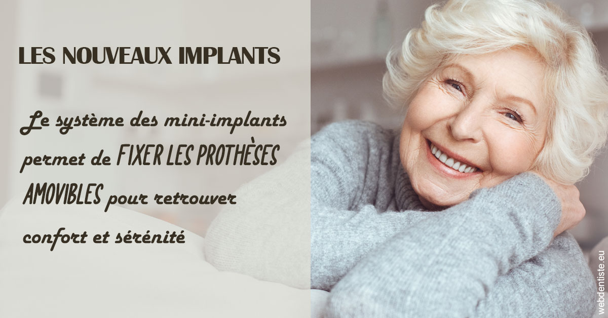https://www.dr-feraud-pedodontiste.fr/Les nouveaux implants 1