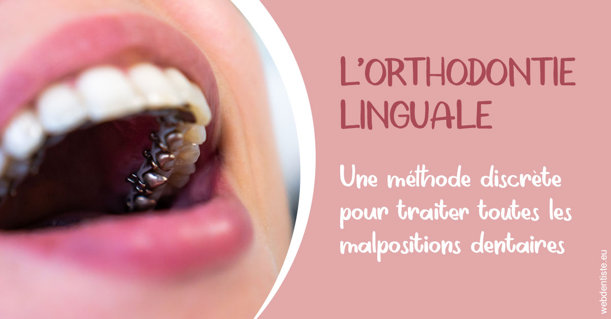 https://www.dr-feraud-pedodontiste.fr/L'orthodontie linguale 2