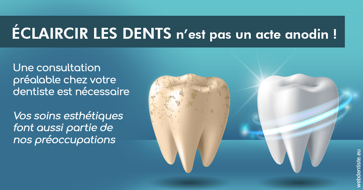 https://www.dr-feraud-pedodontiste.fr/Eclaircir les dents 2