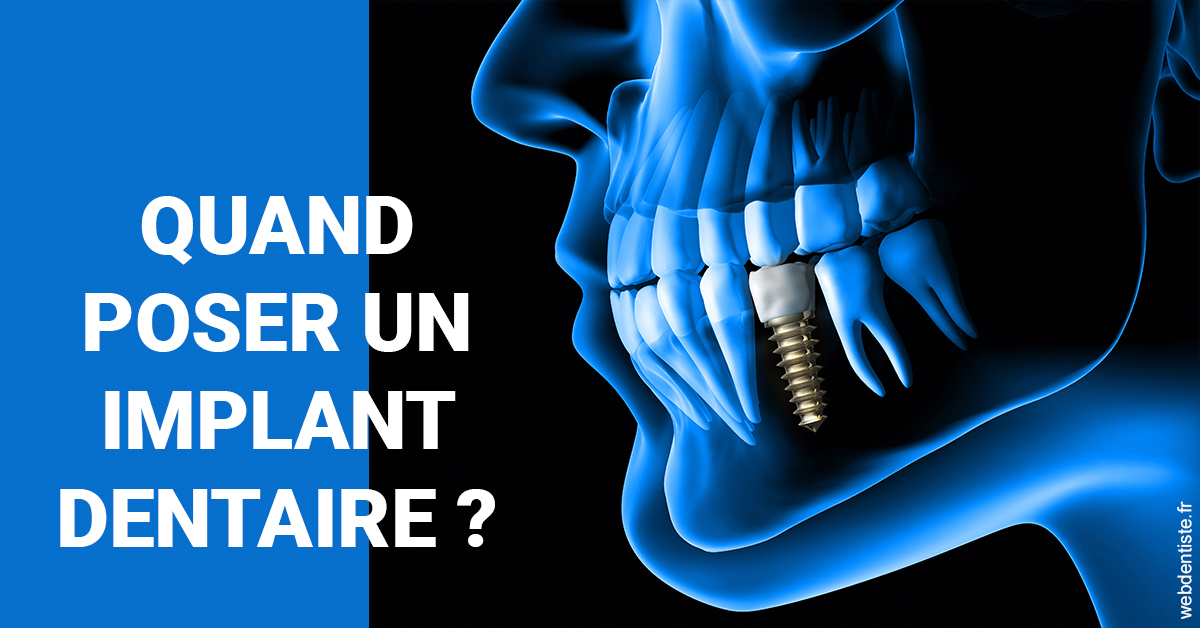 https://www.dr-feraud-pedodontiste.fr/Les implants 1