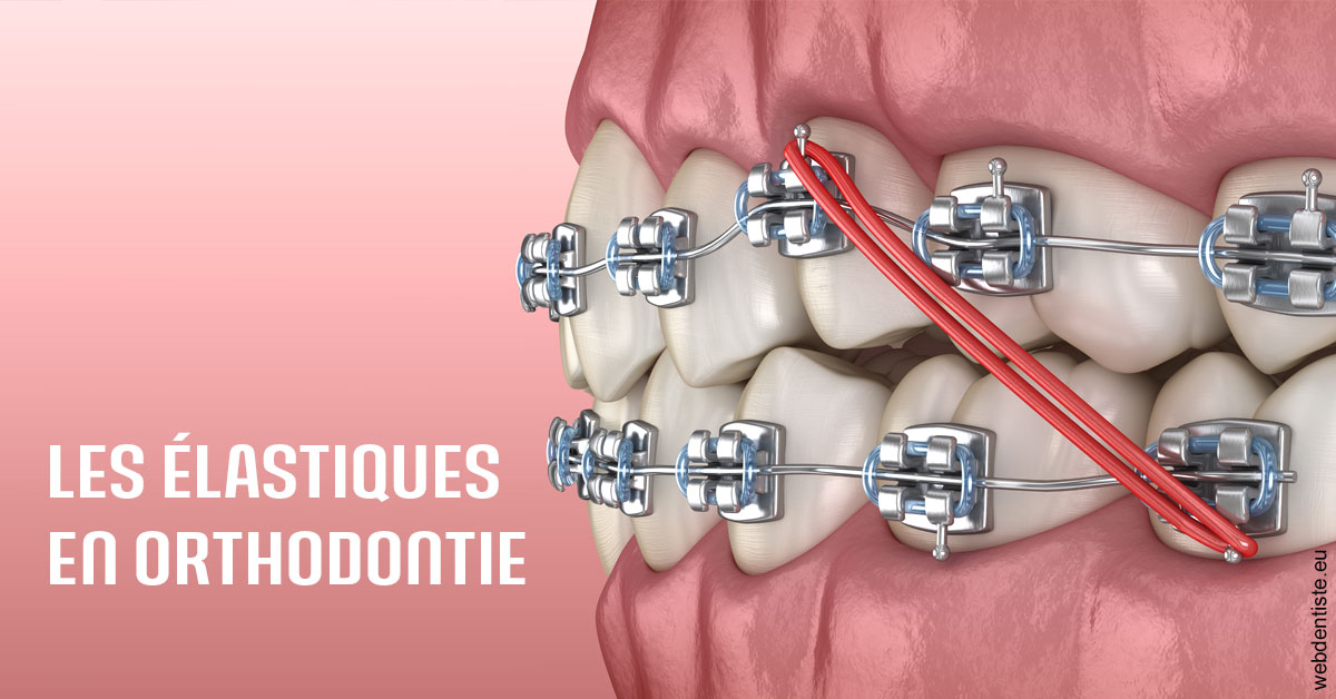 https://www.dr-feraud-pedodontiste.fr/Elastiques orthodontie 2
