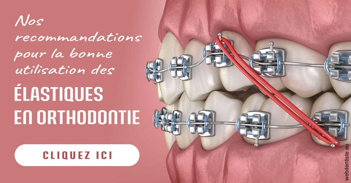 https://www.dr-feraud-pedodontiste.fr/Elastiques orthodontie 2